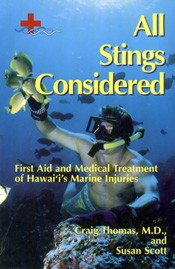 All Stings Considered